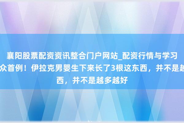 襄阳股票配资资讯整合门户网站_配资行情与学习解析 群众首例！伊拉克男婴生下来长了3根这东西，并不是越多越好